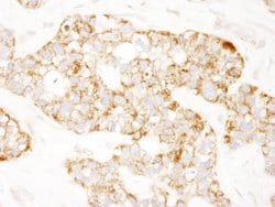 Prohibitin Polyclonal Antibody, Bethyl Laboratories:Antibodies:Primary