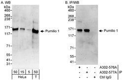Pumilio 1 Rabbit anti-Human, Polyclonal, Bethyl Laboratories 100 &mu;L;
