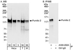 Pumilio 2 Rabbit anti-Human, Mouse, Polyclonal, Bethyl Laboratories 100