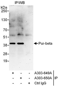 Pur-beta Rabbit anti-Human, Polyclonal, Bethyl Laboratories 10 &mu;L; Unconjugated:Antibodies,