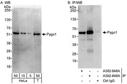 Pygo1 Rabbit anti-Human, Polyclonal, Bethyl Laboratories 100 &mu;L; Unconjugated:Antibodies,