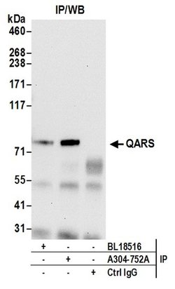 QARS Rabbit anti-Human, Mouse, Polyclonal, Bethyl Laboratories 100 &mu;l;