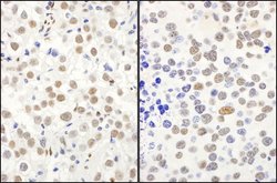 QKI Rabbit anti-Human, Mouse, Polyclonal, Bethyl Laboratories 100 &mu;L;