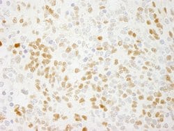 QKI Polyclonal Antibody, Bethyl Laboratories 100 &mu;L; Unconjugated:Antibodies,