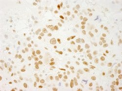 QKI Polyclonal Antibody, Bethyl Laboratories 100 &mu;L; Unconjugated:Antibodies,