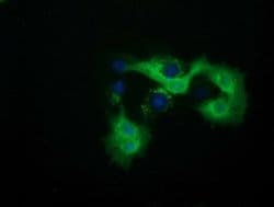 QPRT Mouse anti-Human, Clone: OTI1C10, liquid, TrueMAB 100 &mu;L; Unconjugated:Antibodies,