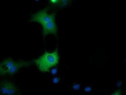 QPRT Mouse anti-Human, Clone: OTI2H4, lyophilized, TrueMAB 100 &mu;g; Unconjugated:Antibodies,