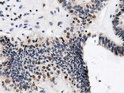 QPRT Monoclonal Antibody (OTI4E6), TrueMAB , OriGene 30 &mu;L; Unconjugated:Antibodies,