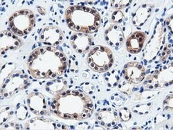 QPRT Monoclonal Antibody (OTI4E6), TrueMAB , OriGene 30 &mu;L; Unconjugated:Antibodies,