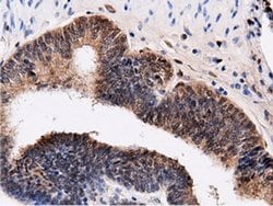 QPRT Mouse anti-Human, Clone: OTI7A8, liquid, TrueMAB 100 &mu;L; Unconjugated:Antibodies,