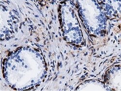QPRT Mouse anti-Human, Clone: OTI7A8, liquid, TrueMAB 100 &mu;L; Unconjugated:Antibodies,