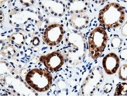QPRT Mouse anti-Human, Clone: OTI7A8, liquid, TrueMAB 100 &mu;L; Unconjugated:Antibodies,