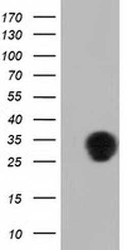QPRT Monoclonal Antibody (OTI4E5), TrueMAB , OriGene 30 &mu;L; Unconjugated:Antibodies,