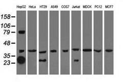 QPRT Monoclonal Antibody (OTI4E5), TrueMAB , OriGene 30 &mu;L; Unconjugated:Antibodies,
