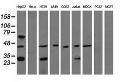QPRT Monoclonal Antibody (OTI4B3), TrueMAB , OriGene 100 &mu;L; Unconjugated:Antibodies,