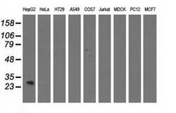 QPRT Monoclonal Antibody (OTI4E6), TrueMAB , OriGene 30 &mu;L; Unconjugated:Antibodies,