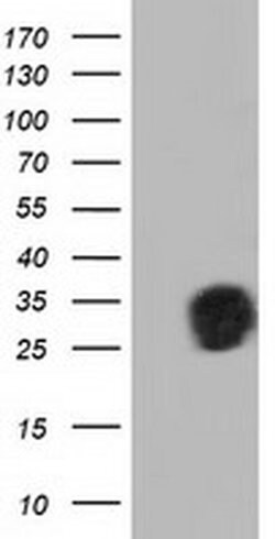 QPRT Monoclonal Antibody (OTI4B4), TrueMAB , OriGene 100 &mu;L; Unconjugated:Antibodies,