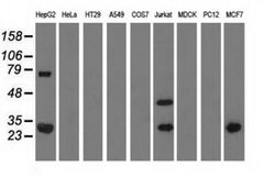 QPRT Monoclonal Antibody (OTI4B4), TrueMAB , OriGene 100 &mu;L; Unconjugated:Antibodies,