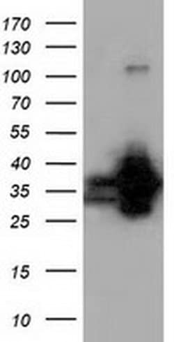 QPRT Mouse anti-Human, Clone: OTI1C10, liquid, TrueMAB 100 &mu;L; Unconjugated:Antibodies,