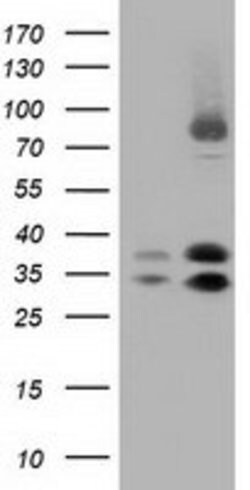 QPRT Mouse anti-Human, Clone: OTI2H4, lyophilized, TrueMAB 100 &mu;g; Unconjugated:Antibodies,