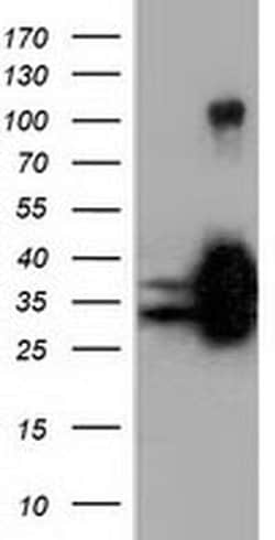 QPRT Mouse anti-Human, Clone: OTI7A8, liquid, TrueMAB 100 &mu;L; Unconjugated:Antibodies,