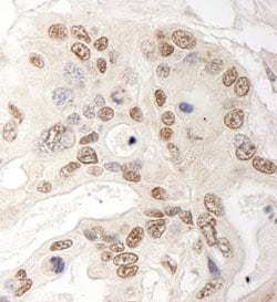 QSER1 Rabbit anti-Human, Polyclonal, Bethyl Laboratories 10 &mu;L; Unconjugated:Antibodies,