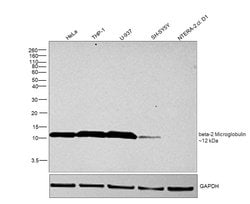 Invitrogen beta-2 Microglobulin Polyclonal Antibody 50 &mu;g; Unconjugated:Antibodies,