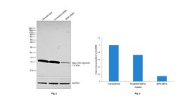 Invitrogen beta-2 Microglobulin Polyclonal Antibody 50 &mu;g; Unconjugated:Antibodies,
