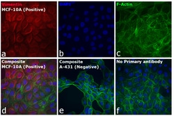 Invitrogen&trade;&nbsp;Goat anti-Rabbit IgG (H+L) Cross-Adsorbed ReadyProbes&trade; Secondary Antibody, Alexa Fluor&trade; 594