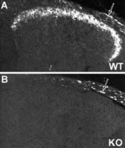 NPY Y2 Receptor Rabbit anti-Mouse, Rat, Polyclonal, Neuromics 50 &mu;L;