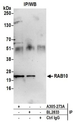 RAB10 Rabbit anti-Human, Mouse, Polyclonal, Bethyl Laboratories 100 &mu;L;