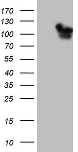 RAB11FIP4 Monoclonal Antibody (OTI4C9), TrueMAB , OriGene 100 &mu;L; Unconjugated:Antibodies,