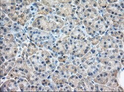 RAB17 Mouse anti-Human, Clone: OTI5E2, liquid, TrueMAB 100 &mu;L; Unconjugated:Antibodies,