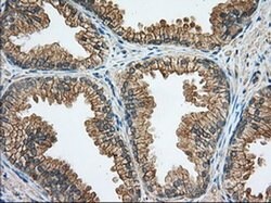 RAB17 Mouse anti-Human, Clone: OTI5E2, liquid, TrueMAB 100 &mu;L; Unconjugated:Antibodies,