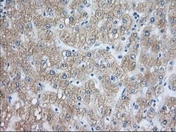 RAB17 Mouse anti-Human, Clone: OTI5E2, liquid, TrueMAB 100 &mu;L; Unconjugated:Antibodies,