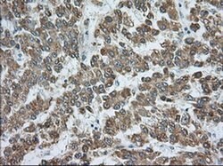 RAB17 Mouse anti-Human, Clone: OTI5E2, liquid, TrueMAB 100 &mu;L; Unconjugated:Antibodies,