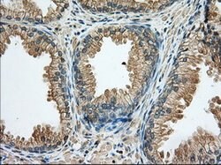 RAB17 Mouse anti-Human, Clone: OTI3A5, lyophilized, TrueMAB 100 &mu;g;