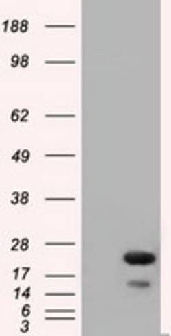 RAB17 Mouse anti-Human, Clone: OTI3A5, lyophilized, TrueMAB 100 &mu;g;