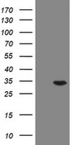 RAB20 Monoclonal Antibody (OTI1F1), TrueMAB , OriGene 100 &mu;L; Unconjugated:Antibodies,