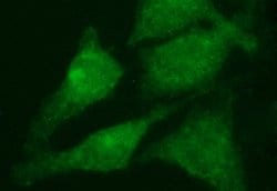 RAB21 Monoclonal Antibody (OTI6G3), TrueMAB , OriGene 100 &mu;L; Unconjugated:Antibodies,