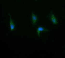 RAB21 Monoclonal Antibody (OTI6A9), TrueMAB , OriGene 100 &mu;L; Unconjugated:Antibodies,