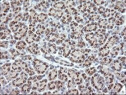 RAB21 Monoclonal Antibody (OTI6G1), TrueMAB , OriGene 100 &mu;L; Unconjugated:Antibodies,
