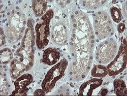 RAB21 Monoclonal Antibody (OTI6G1), TrueMAB , OriGene:Antibodies:Primary