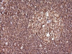 RAB21 Monoclonal Antibody (OTI6G3), TrueMAB , OriGene 100 &mu;L; Unconjugated:Antibodies,