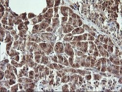 RAB21 Monoclonal Antibody (OTI6A9), TrueMAB , OriGene 100 &mu;L; Unconjugated:Antibodies,