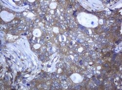 RAB21 Monoclonal Antibody (OTI5B12), TrueMAB , OriGene 100 &mu;L; Unconjugated:Antibodies,