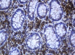 RAB21 Monoclonal Antibody (OTI5B12), TrueMAB , OriGene 100 &mu;L; Unconjugated:Antibodies,