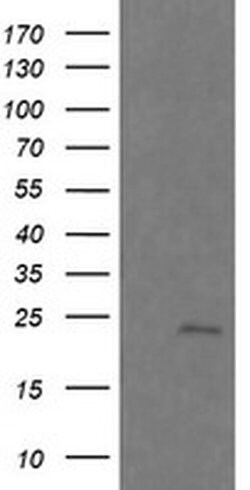 RAB21 Monoclonal Antibody (OTI6G1), TrueMAB , OriGene 100 &mu;L; Unconjugated:Antibodies,