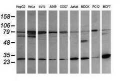 RAB21 Monoclonal Antibody (OTI6G1), TrueMAB , OriGene:Antibodies:Primary