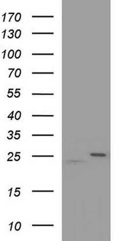 RAB21 Monoclonal Antibody (OTI6G3), TrueMAB , OriGene:Antibodies:Primary